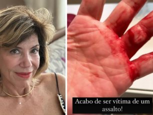 Silvia Poppovic é vítima de assalto violento em São Paulo